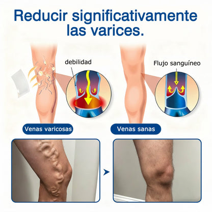🇭🇺👨‍⚕️✅ GFOUK® VeinEase nano-mikrotűs tapasz a visszerek ápolására ⚡ Azonnali enyhülés, hosszú távú eredmények