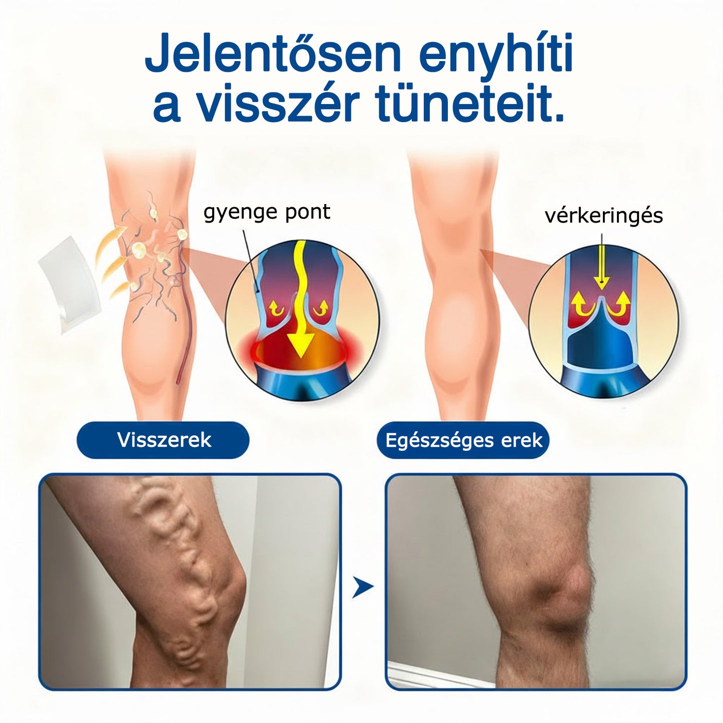 🇭🇺👨‍⚕️✅ GFOUK® VeinEase nano-mikrotűs tapasz a visszerek ápolására ⚡ Azonnali enyhülés, hosszú távú eredmények
