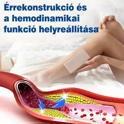🇭🇺👨‍⚕️✅ GFOUK® VeinEase nano-mikrotűs tapasz a visszerek ápolására ⚡ Azonnali enyhülés, hosszú távú eredmények