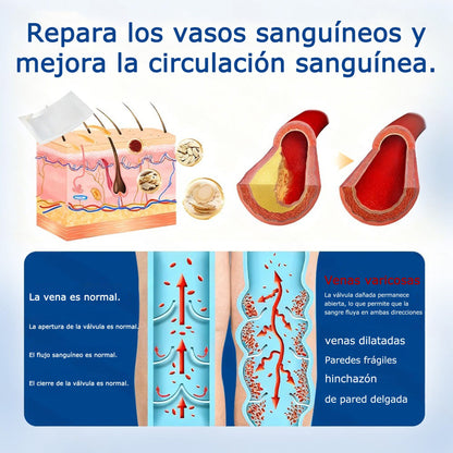 🇭🇺👨‍⚕️✅ GFOUK® VeinEase nano-mikrotűs tapasz a visszerek ápolására ⚡ Azonnali enyhülés, hosszú távú eredmények