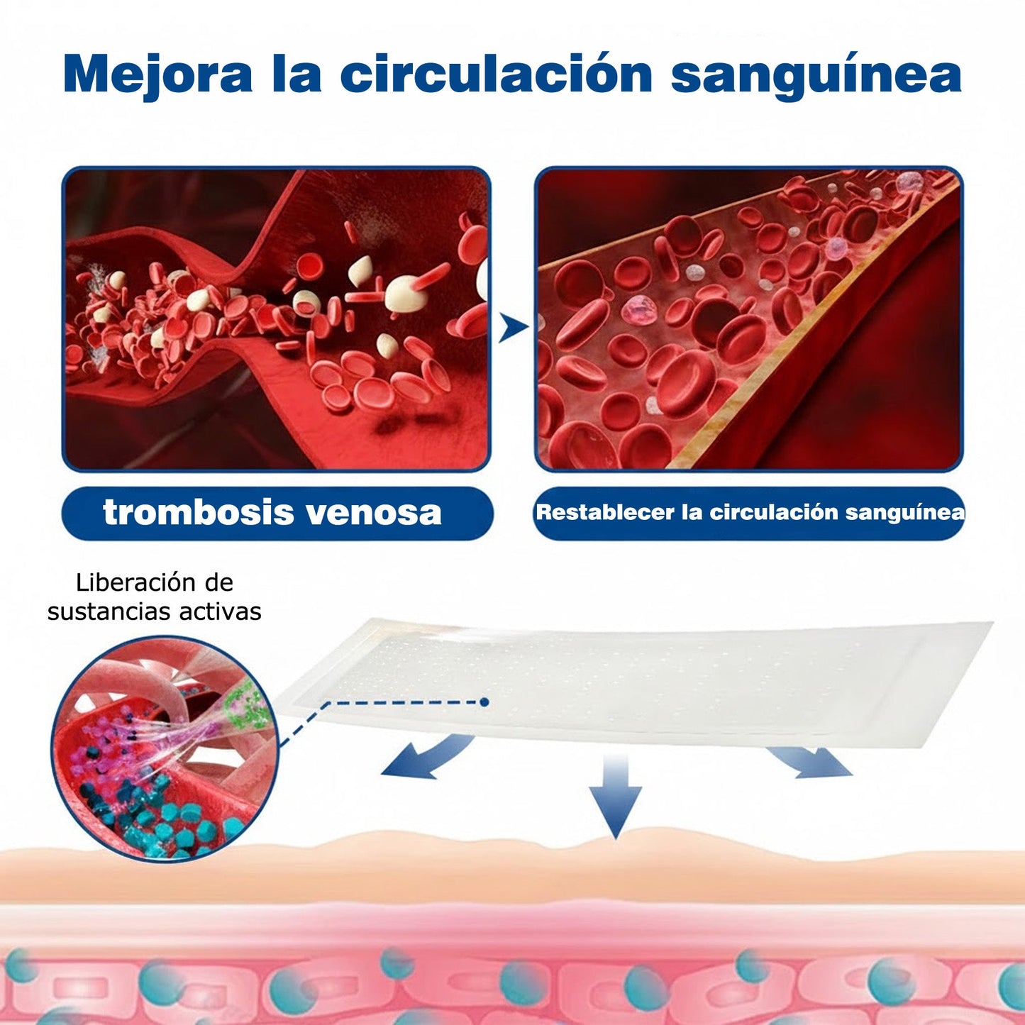 🇭🇺👨‍⚕️✅ GFOUK® VeinEase nano-mikrotűs tapasz a visszerek ápolására ⚡ Azonnali enyhülés, hosszú távú eredmények