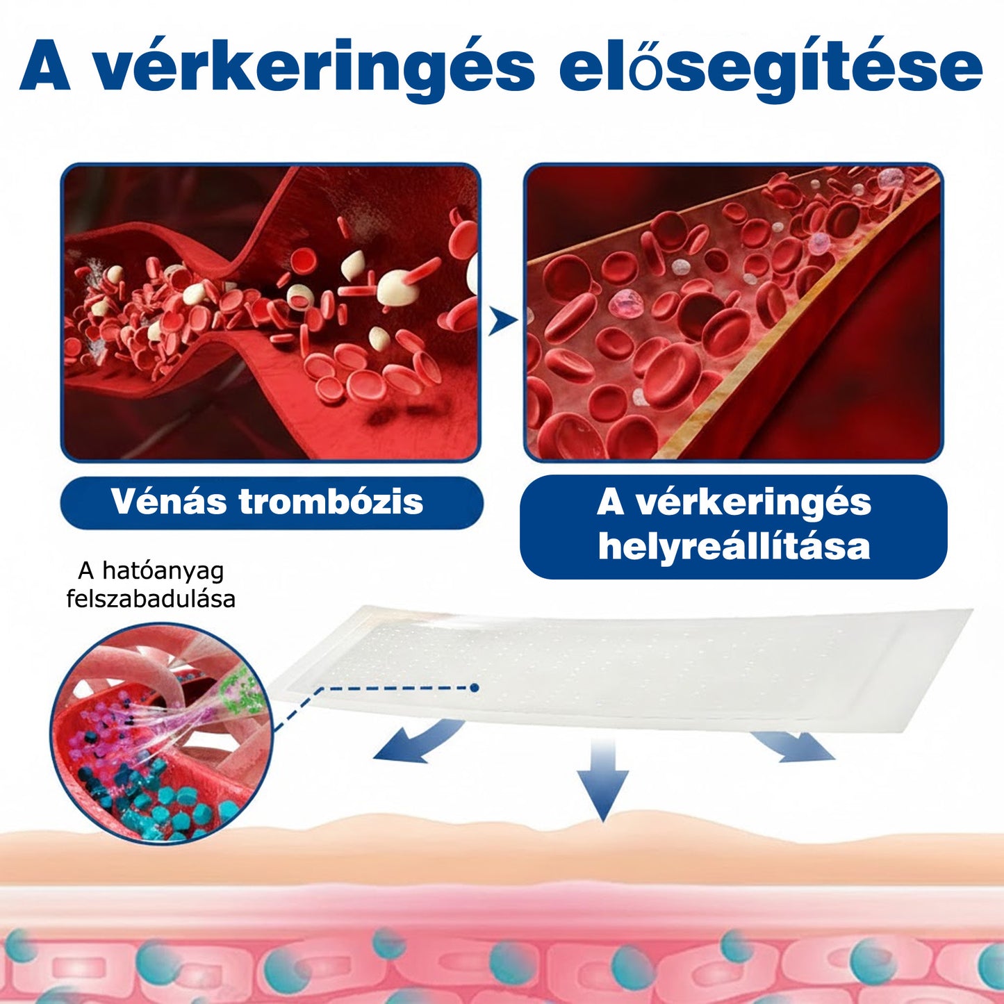 🇭🇺👨‍⚕️✅ GFOUK® VeinEase nano-mikrotűs tapasz a visszerek ápolására ⚡ Azonnali enyhülés, hosszú távú eredmények
