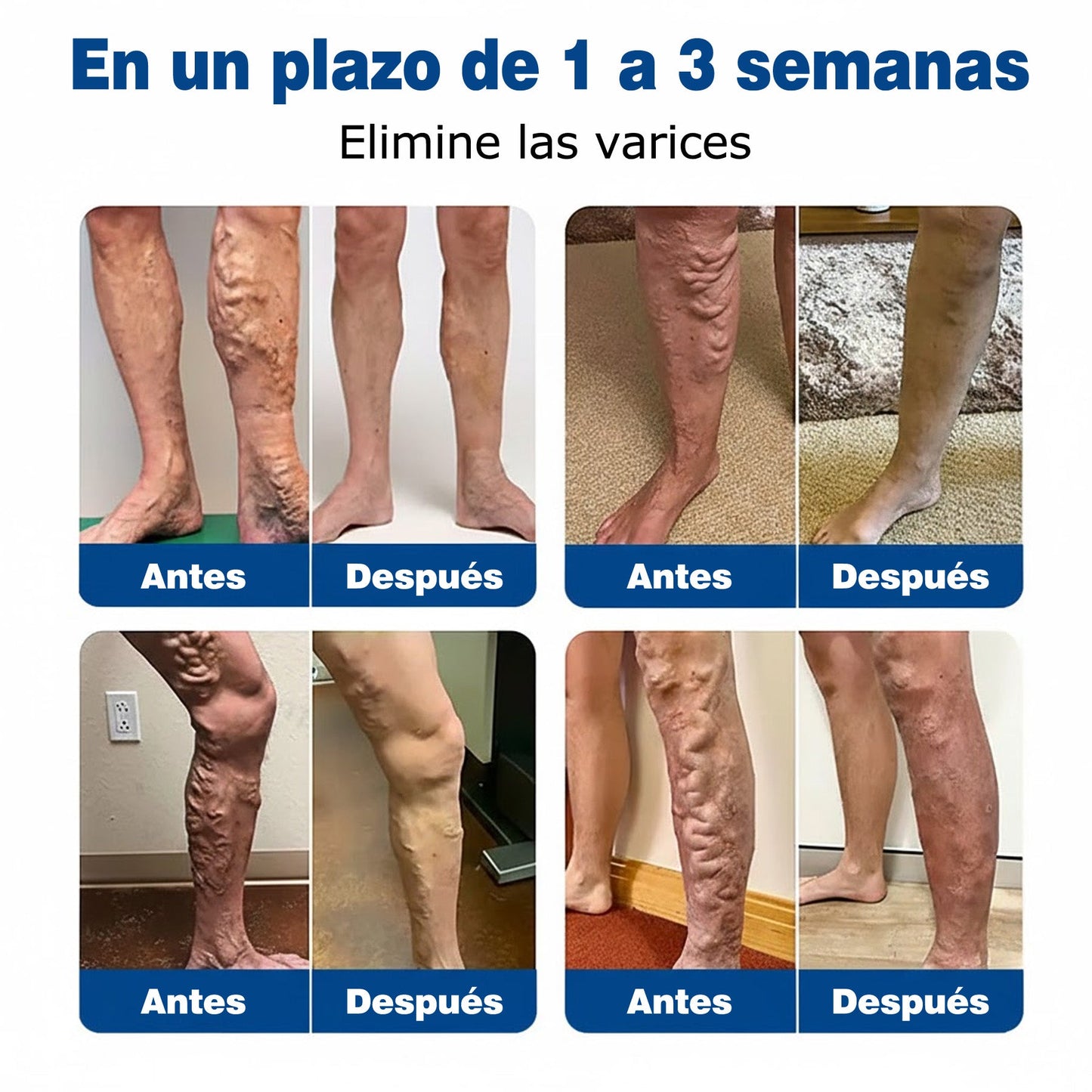 🇭🇺👨‍⚕️✅ GFOUK® VeinEase nano-mikrotűs tapasz a visszerek ápolására ⚡ Azonnali enyhülés, hosszú távú eredmények